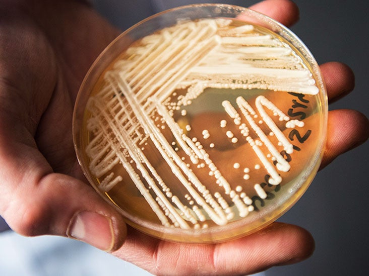 Brazil has reported its first cases of a potentially fatal fungal infection called Candida auris (C. auris) that is becoming increasingly resistant to