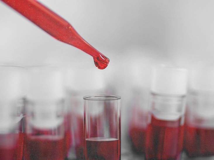 トラタミエント