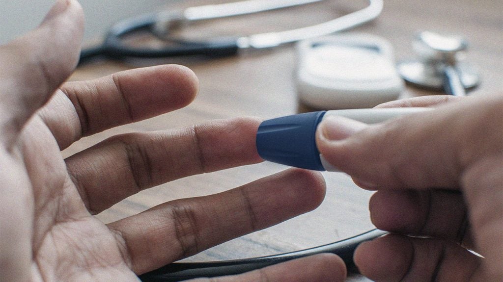 HDL blood test What is measured, what does it mean?