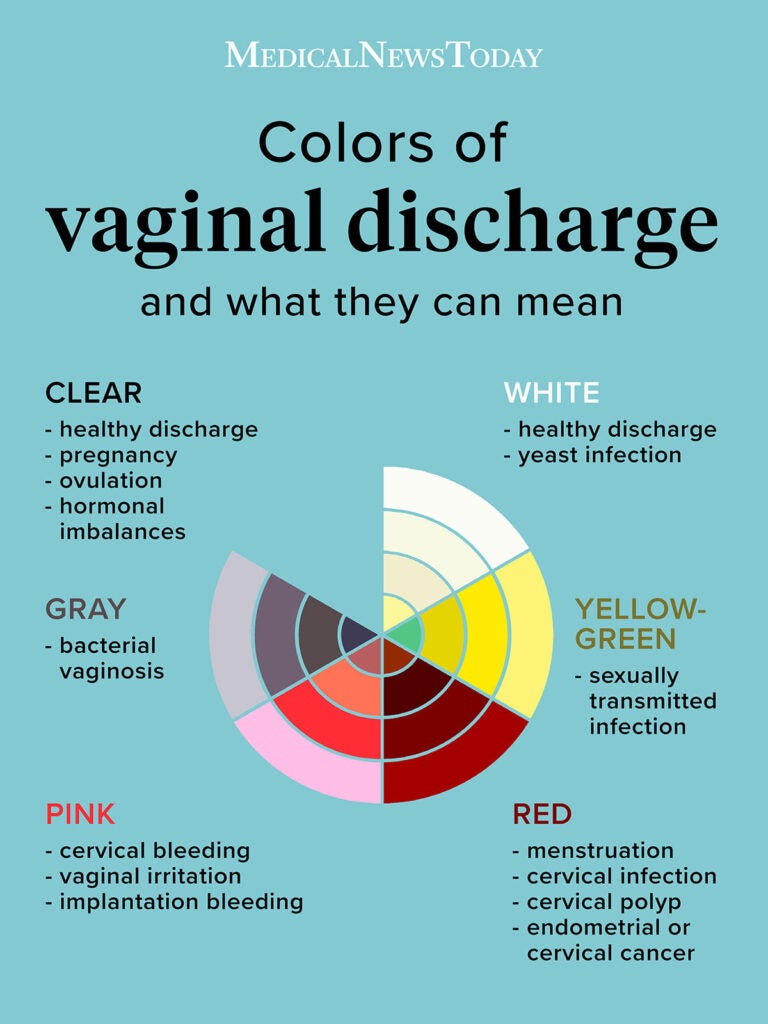 Vaginal discharge definition: A guide