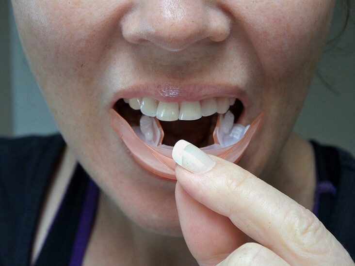 diy whitening strips without hydrogen peroxide