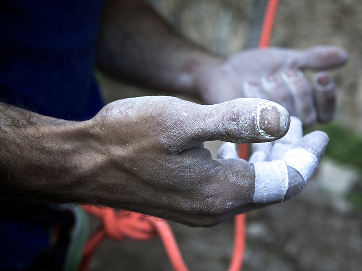 Corns and calluses What's the difference and how can I treat them?