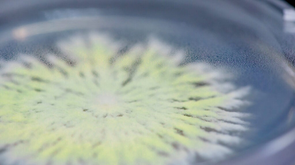 IBD Antifungal vaccine may help reduce inflammation