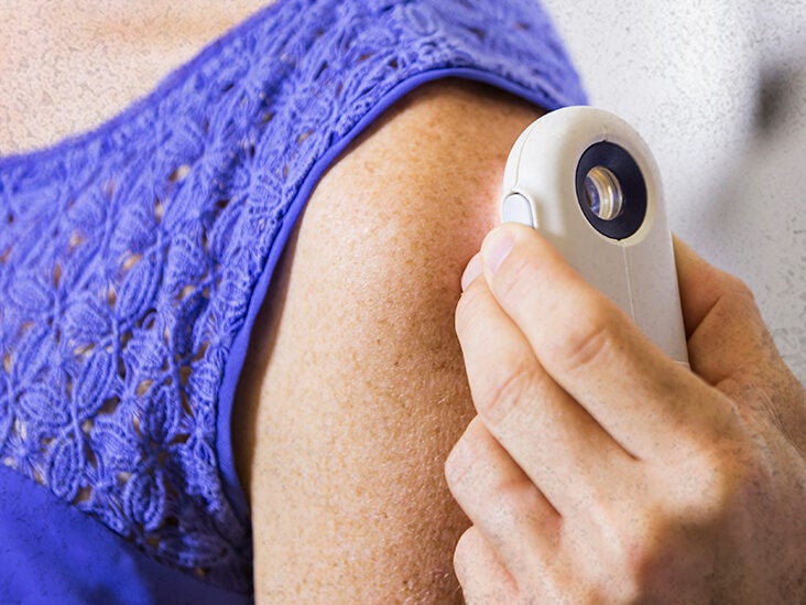 Agent Orange Exposure Increases Skin Cancer Risk In Vietnam Veterans