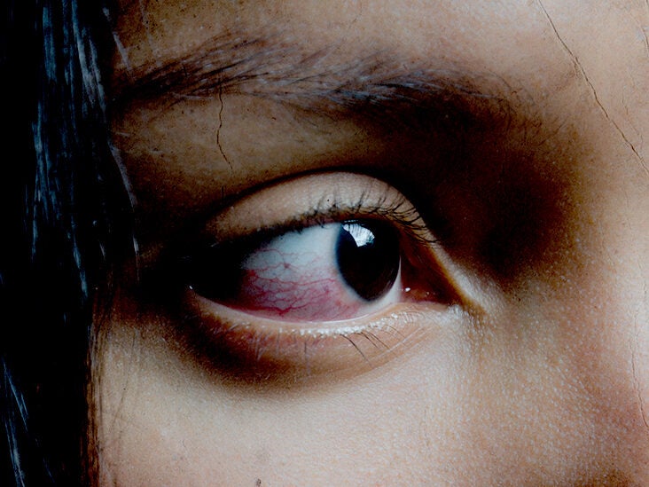 eyes: of common causes