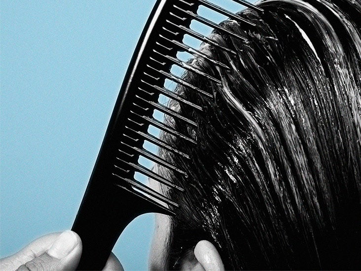 Scalp psoriasis and hair loss: What is the connection?