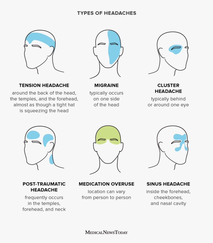 pain at the back of head sinus infection