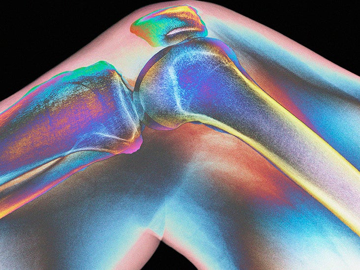 Lateral collateral ligament injuries: Causes and recovery times