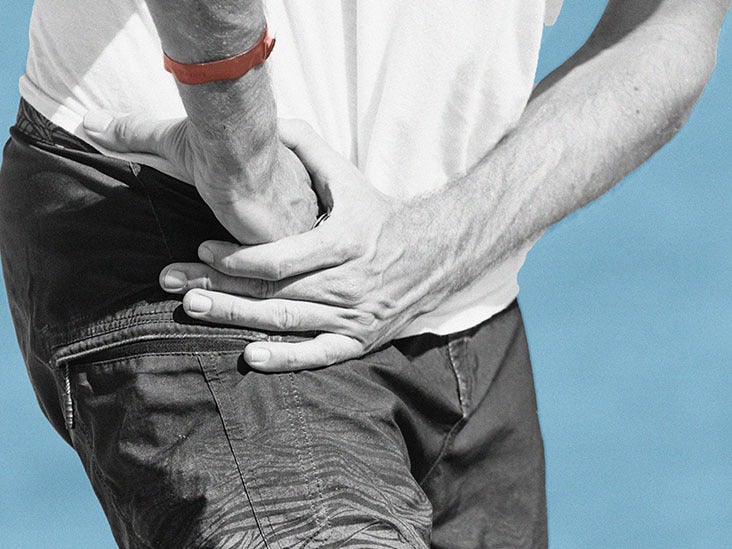 Piriformis Syndrome: What Is It, Causes, Diagnosis, and More