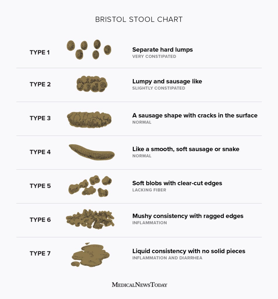 Bristol Stool scale: Stool types and what they mean