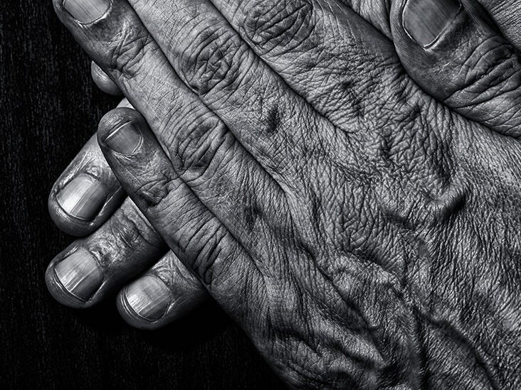 Wrinkles On Black Skin Causes Treatment And Prevention