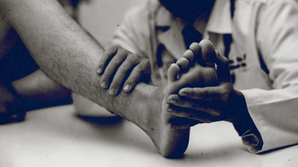 Psoriatic arthritis and nails Changes, pictures, and treatment