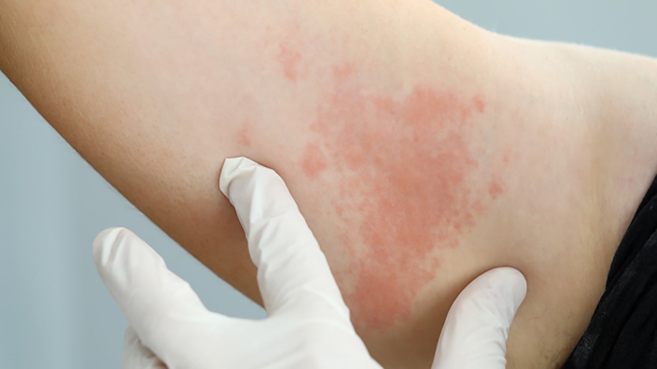 Skin diseases: A list of common conditions and symptoms