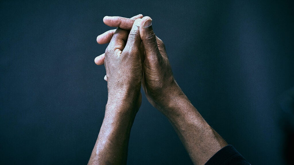 健康・医学 A Colour Atlas of Rheumatoid Hand Hand Rheumatoid Arthritis Model - Clinical Charts and Supplies