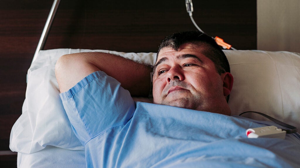 What is vertical sleeve gastrectomy (VSG) surgery?