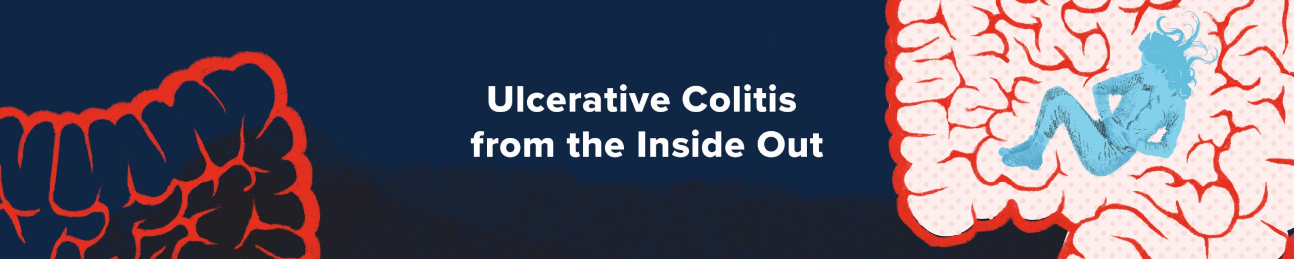 Ulcerative Colitis from the Inside Out