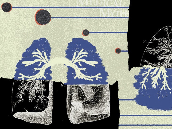 13 myths about lung cancer - Vimarsana News
