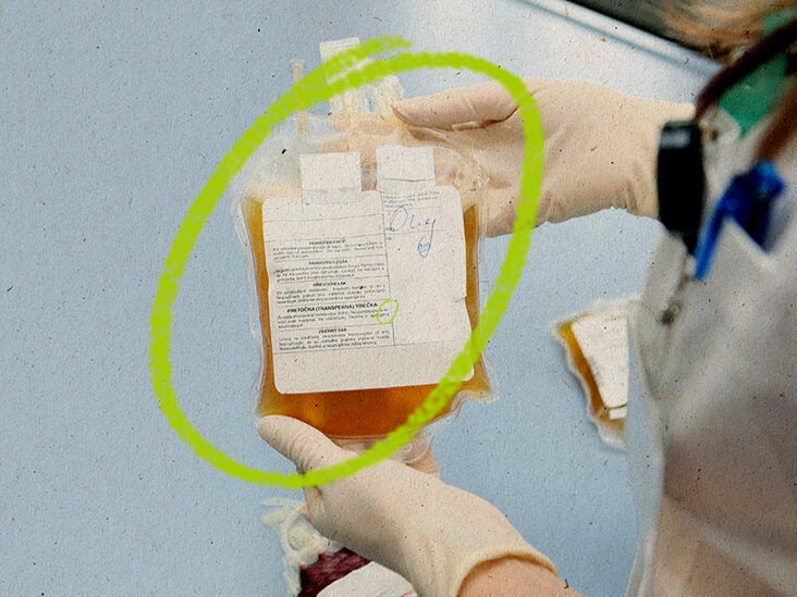 Can You Donate Plasma If You Have Hepatitis C