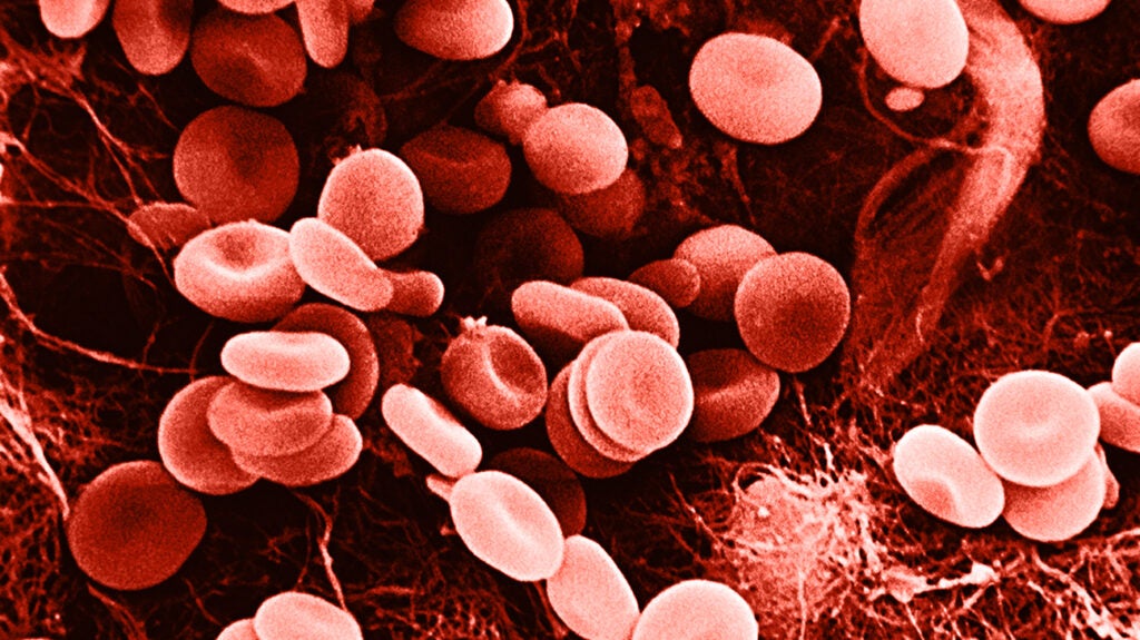 Blood cells: Types and Their Functions • Microbe Online