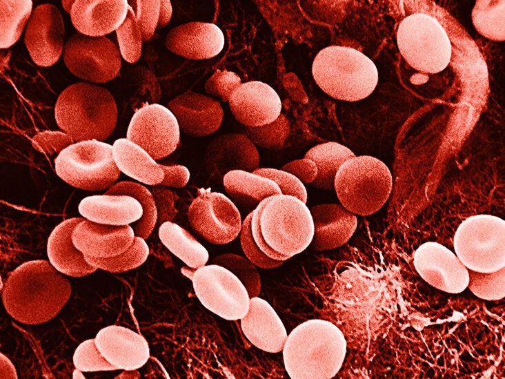 Low red blood cell count (anemia): Symptoms, and more