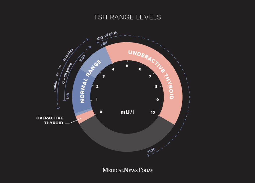 TSH Levels Low to high ranges, symptoms, and what they mean