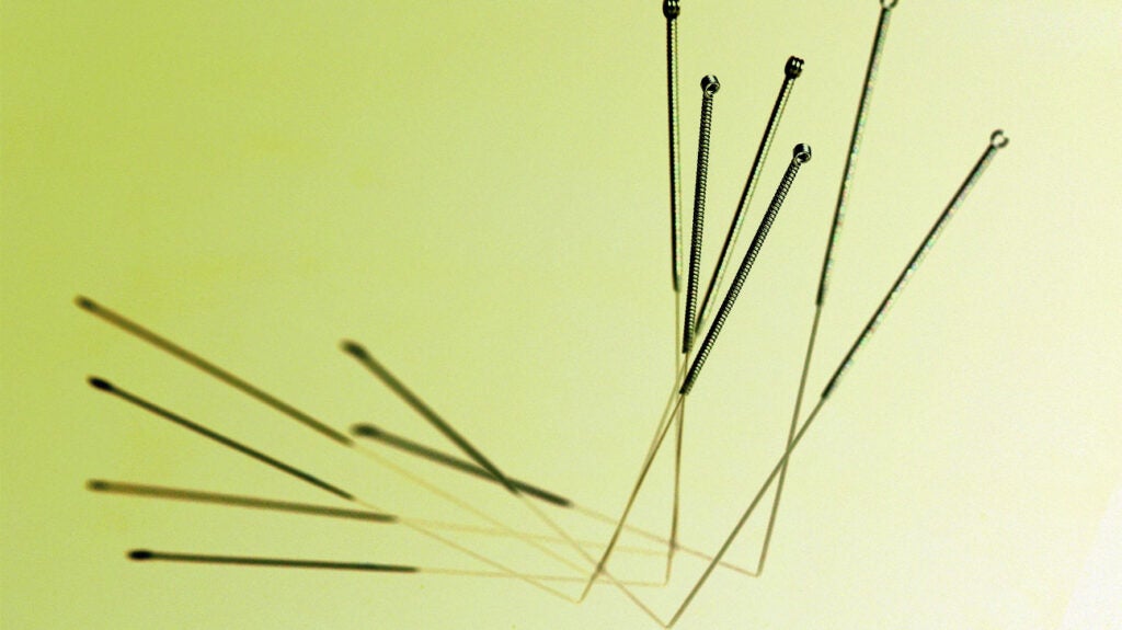 Can acupuncture help relieve pain due to shingles?