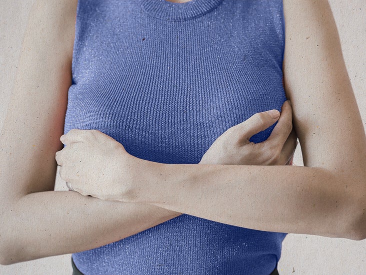 Breast Eczema - What to Know Eczema Care Company