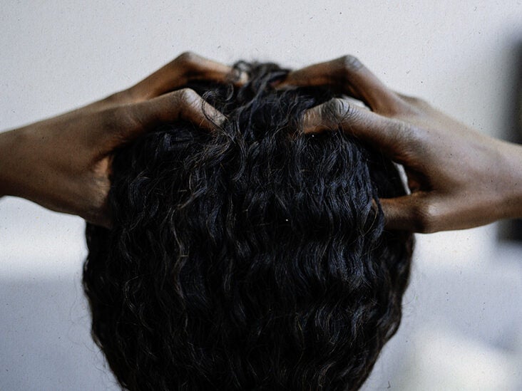 Does Scalp Eczema Cause Hair Loss