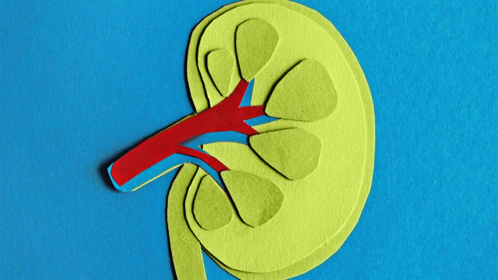 Stage 5 chronic kidney disease (CKD)