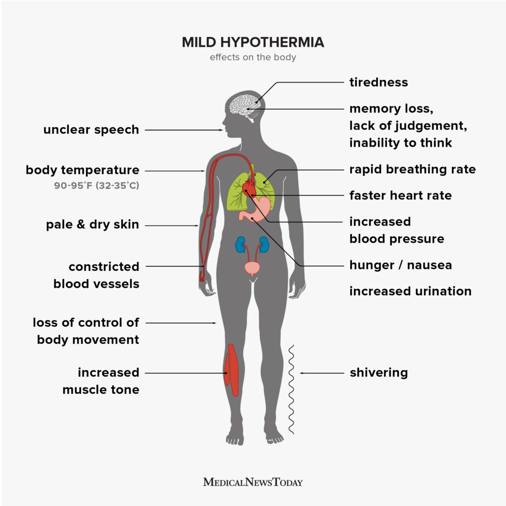 Hypothermia Symptoms Treatment Stages And More