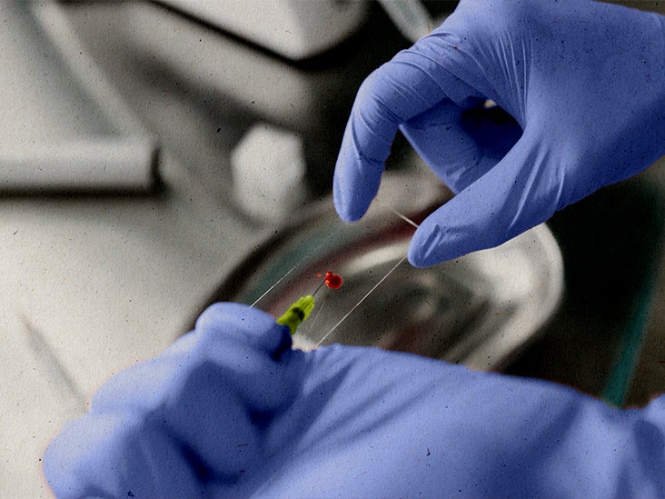 Pancytopenia Symptoms, causes, and treatment