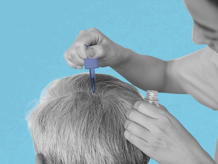 7 of the best hair loss treatments for men in 2022