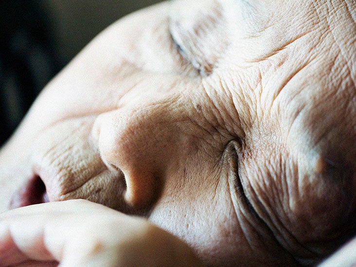 anti aging rendellenesség ilem csoport svájci anti aging