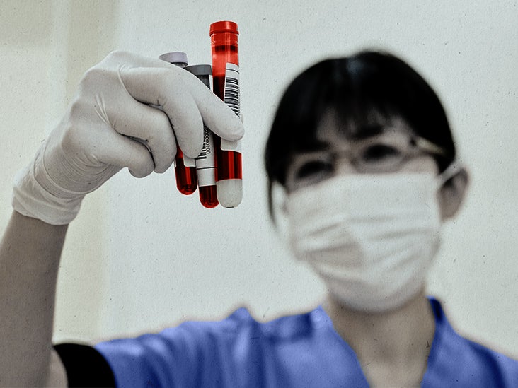 ANA blood test Purpose, what to expect, results explained, and more