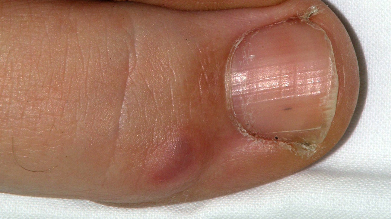 Bumps on gel nails? : r/Nails