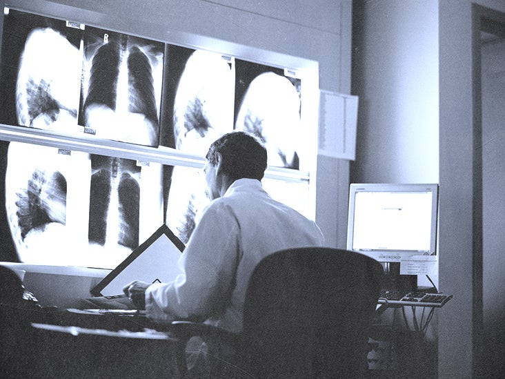 How to detect lung cancer CT scan, tests, and more