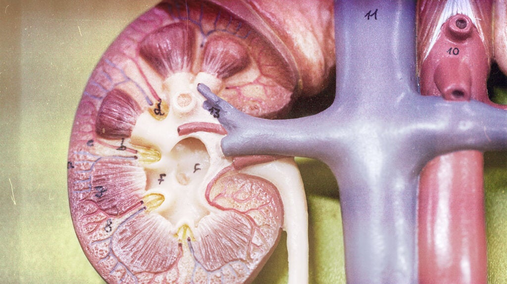 What is the link between microalbuminuria and diabetic nephropathy?