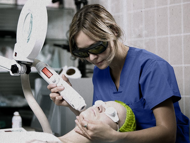 CO2 Laser Resurfacing: Benefits, What to Expect, Safety, Cost