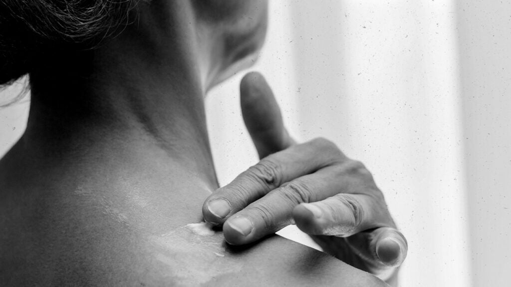 How and why to apply lotion to your back