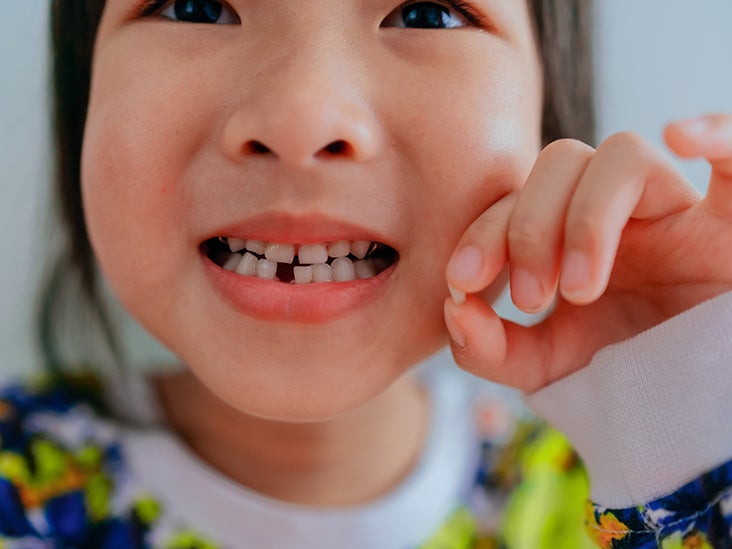 When Kids Lose Their First Tooth What To Do How Early And More