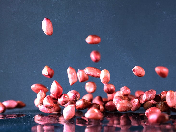 Peanut allergy: Symptoms, treatment, and management
