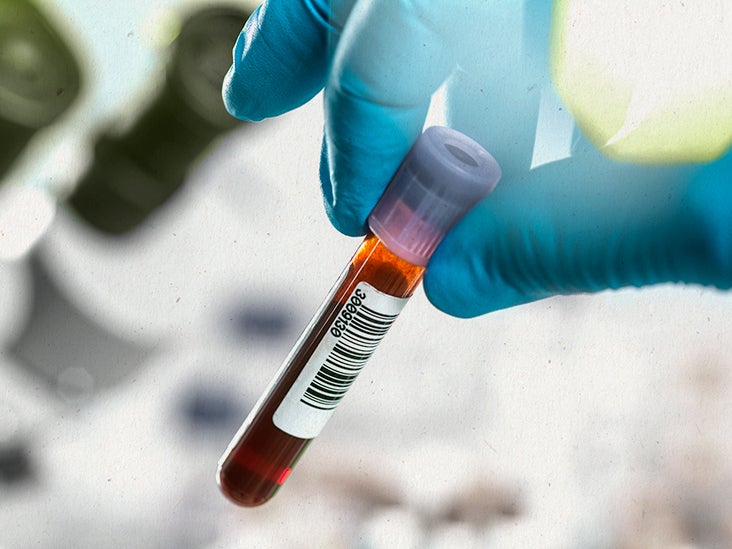 New Blood Test May Revolutionize Early Cancer Detection