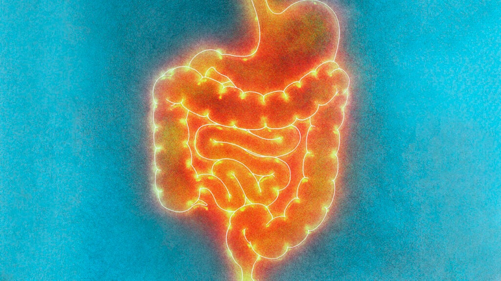 Proctitis Vs. Ulcerative Colitis: Differences And More