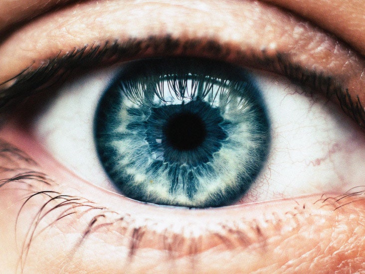 Evaporative dry eye Symptoms, risk factors, and treatment