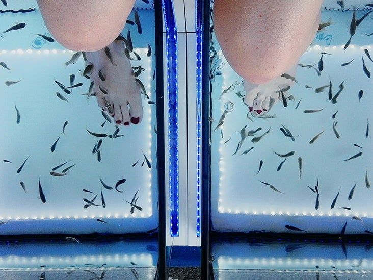 Fish pedicures: Safety, benefits, and ethics