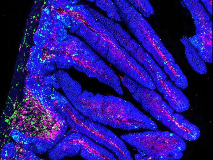 Intestinal ‘virome’ could be missing link