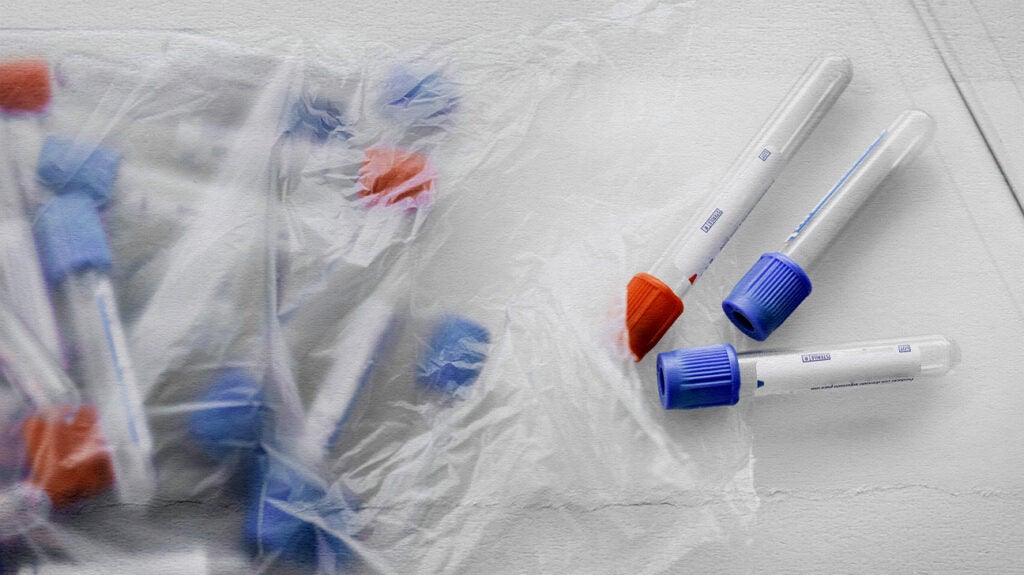 Herpes antibodies Overview, test, symptoms, and more