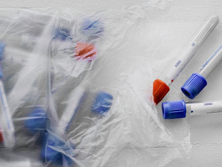 Herpes antibodies Overview, test, symptoms, and more