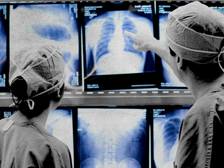 Pneumomediastinum: Symptoms, causes, and treatment