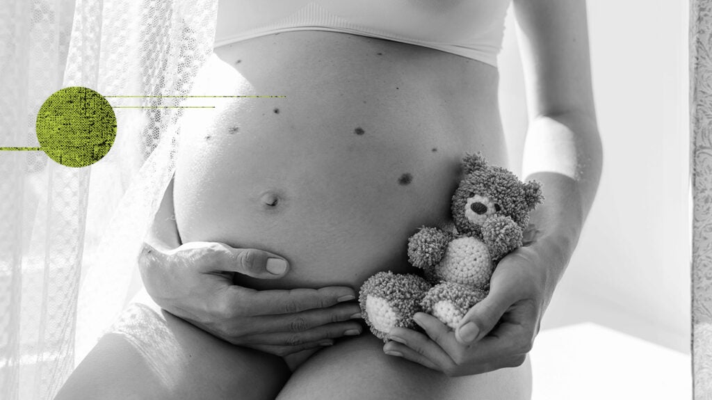Pregnancy and moles: Link and when to seek help
